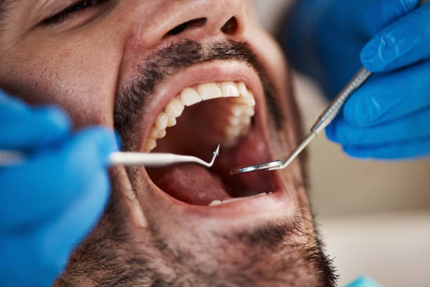 Best Emergency Dental Extractions in Coats Bend, AL